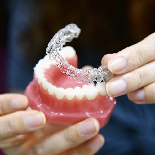 Dentist placing Invisalign tray on model smile