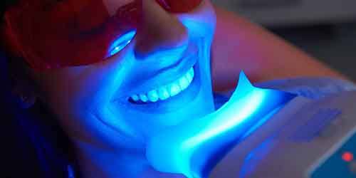 Woman undergoing teeth whitening at the dentist’s office